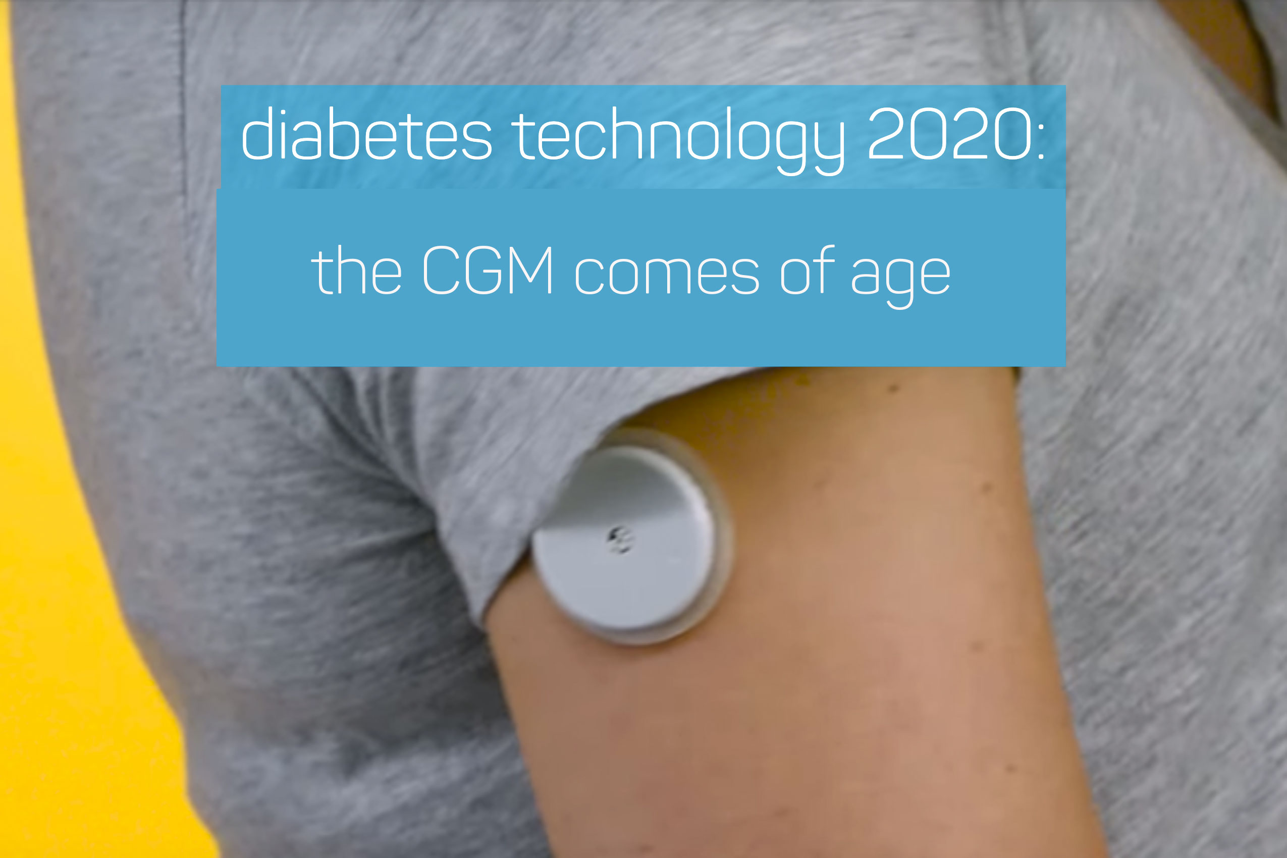 CGM-Technology-2020